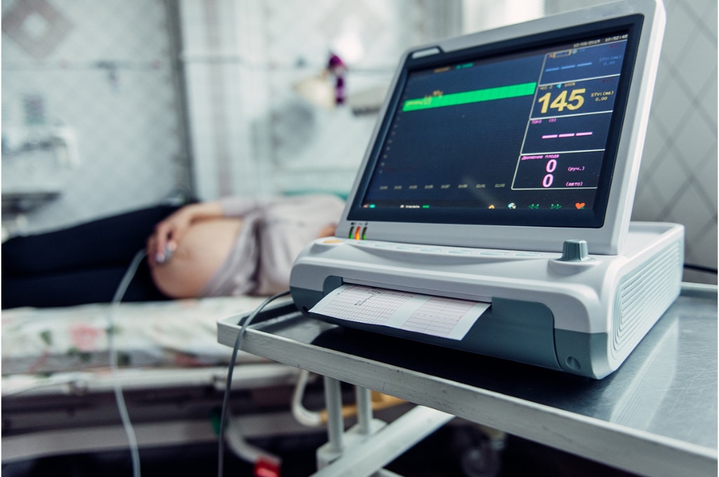 vue sur un éléctrocardiogramme qui mesure la fréquence des battements du coeur d'une foetus dans le ventre de sa mère.
